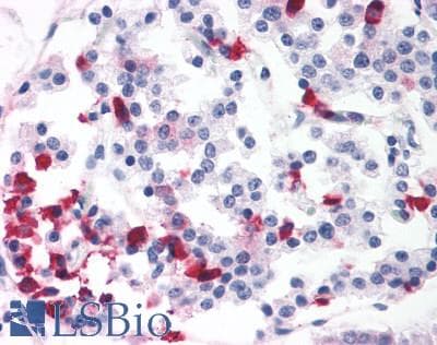 PathPlus™ BRS3 Antibody (N-Terminus)
