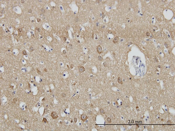 SH3GL2 Antibody (clone 5A6)