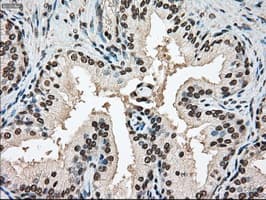SSB / La Antibody (clone OTI2C8)