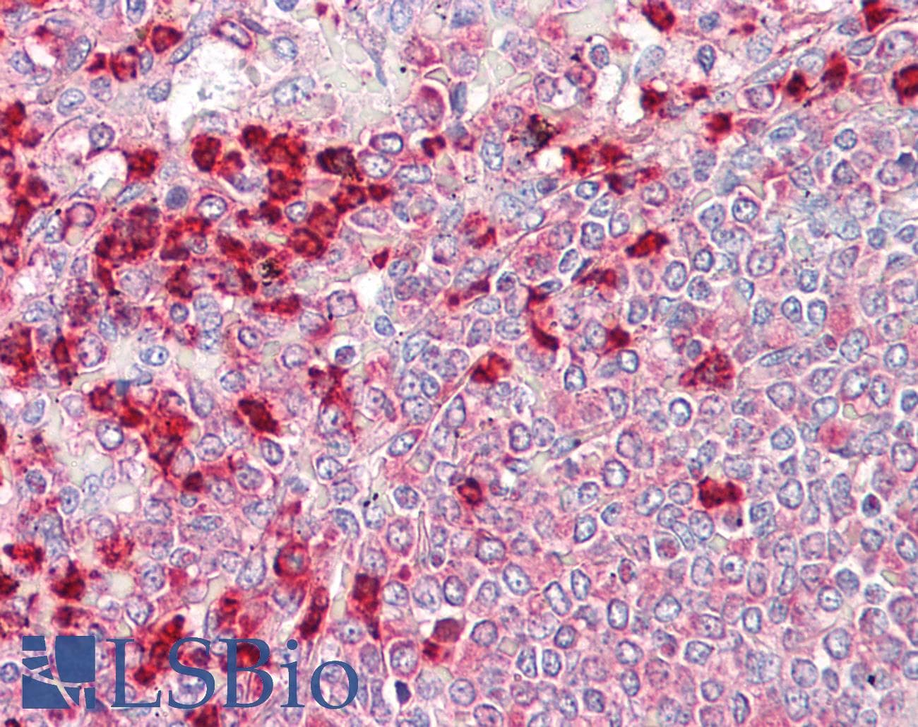 IHC-plus™ Polyclonal Rabbit anti-Human LF / LTF / Lactoferrin Antibody (IHC, WB)