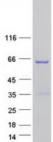 Human TSEN54 Protein (Recombinant Myc-DDK (Flag))