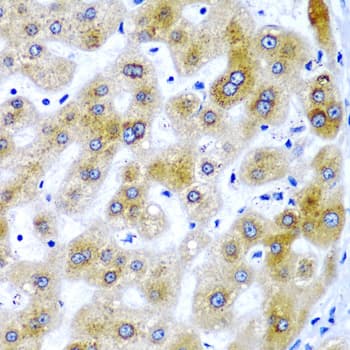 Polyclonal Rabbit anti-Human SECISBP2 / SBP2 Antibody (IHC, IF, WB)