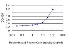 UROD Antibody (clone 1G4)