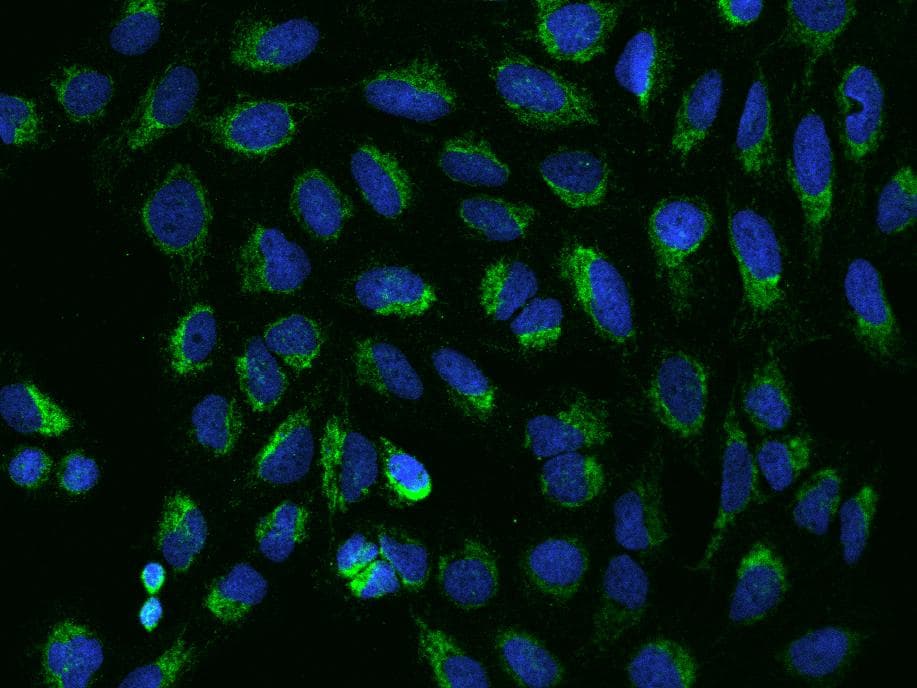 Polyclonal Rabbit anti-Human VDAC2 Antibody (IHC, IF, WB)