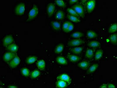 ADCK4 Antibody