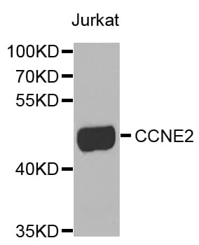 CCNE2 / Cyclin E2 Antibody