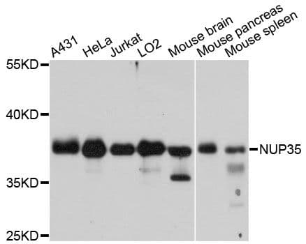 Polyclonal Rabbit anti-Human NUP35 / NUP53 Antibody (WB)