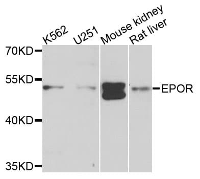 Polyclonal Rabbit anti-Human EPOR / EPO Receptor Antibody (IHC, WB)