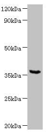 Polyclonal Rabbit anti-Human WDR54 Antibody (WB)