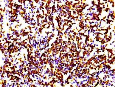 HIST1H4I Antibody