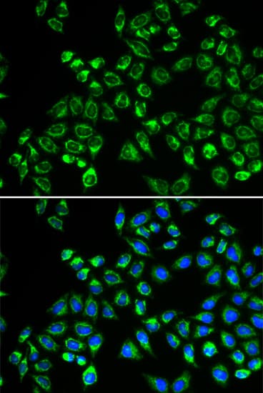GC1qR / C1QBP Antibody