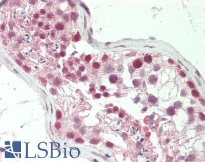 RARG / RAR-Gamma Antibody (aa143-192)