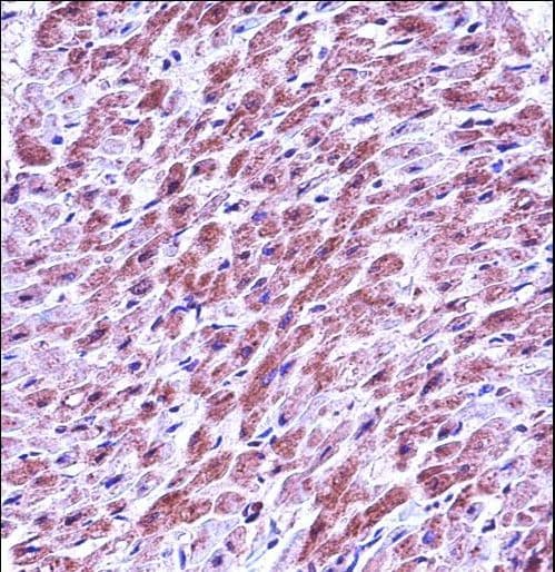 SMAD3 Antibody (aa127-156)