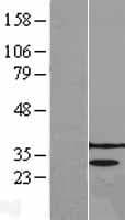 PRPK / TP53RK Protein (Over-Expression Lysate Myc-DDK (Flag))