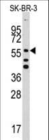 IHC-plus™ ALDH5A1 Antibody (aa368-398)