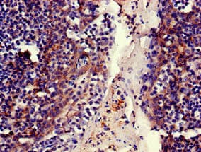 Polyclonal Rabbit anti-Human MFI2 / p97 Antibody