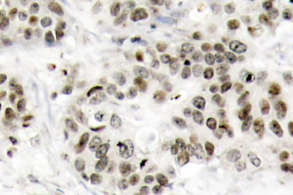 JNK1+2+3 Antibody (Tyr185)