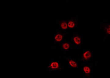 Polyclonal Rabbit anti-Human TP53BP1 / 53BP1 Antibody (phospho-Thr543, IF, WB)