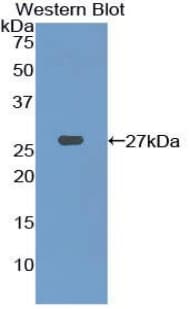 PFKP Antibody (aa553-753)