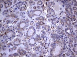 CD30 Antibody (clone OTI16H5)