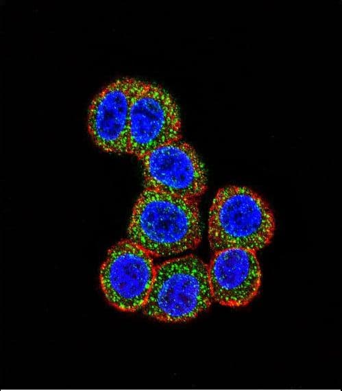 Polyclonal Rabbit anti-Human RAF1 / RAF Antibody (aa1-30, IHC, IF, WB)