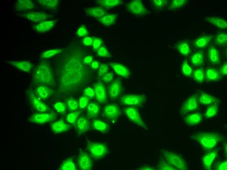 Polyclonal Rabbit anti-Human RNF40 / STARING Antibody (IHC, IF, WB)