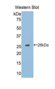 TNFRSF21 / DR6 Antibody (aa406-605)