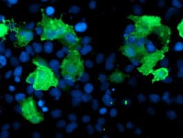 LIMK1 / LIMK Antibody (clone OTI3A3)