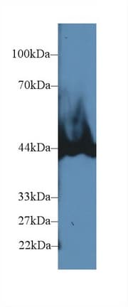 CPB / Carboxypeptidase B Antibody (aa111-417, Biotin)