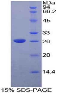 Rat DNASE1L2 Protein (Recombinant His-T7)