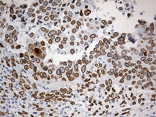 Monoclonal Mouse anti-Human SLU7 / 9G8 Antibody (clone OTI5A7, aa1-300, IHC, WB)