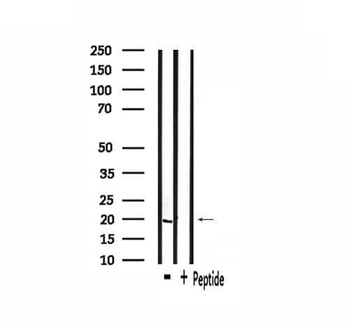 Polyclonal Rabbit anti-Human INSL4 Antibody (IF, WB)
