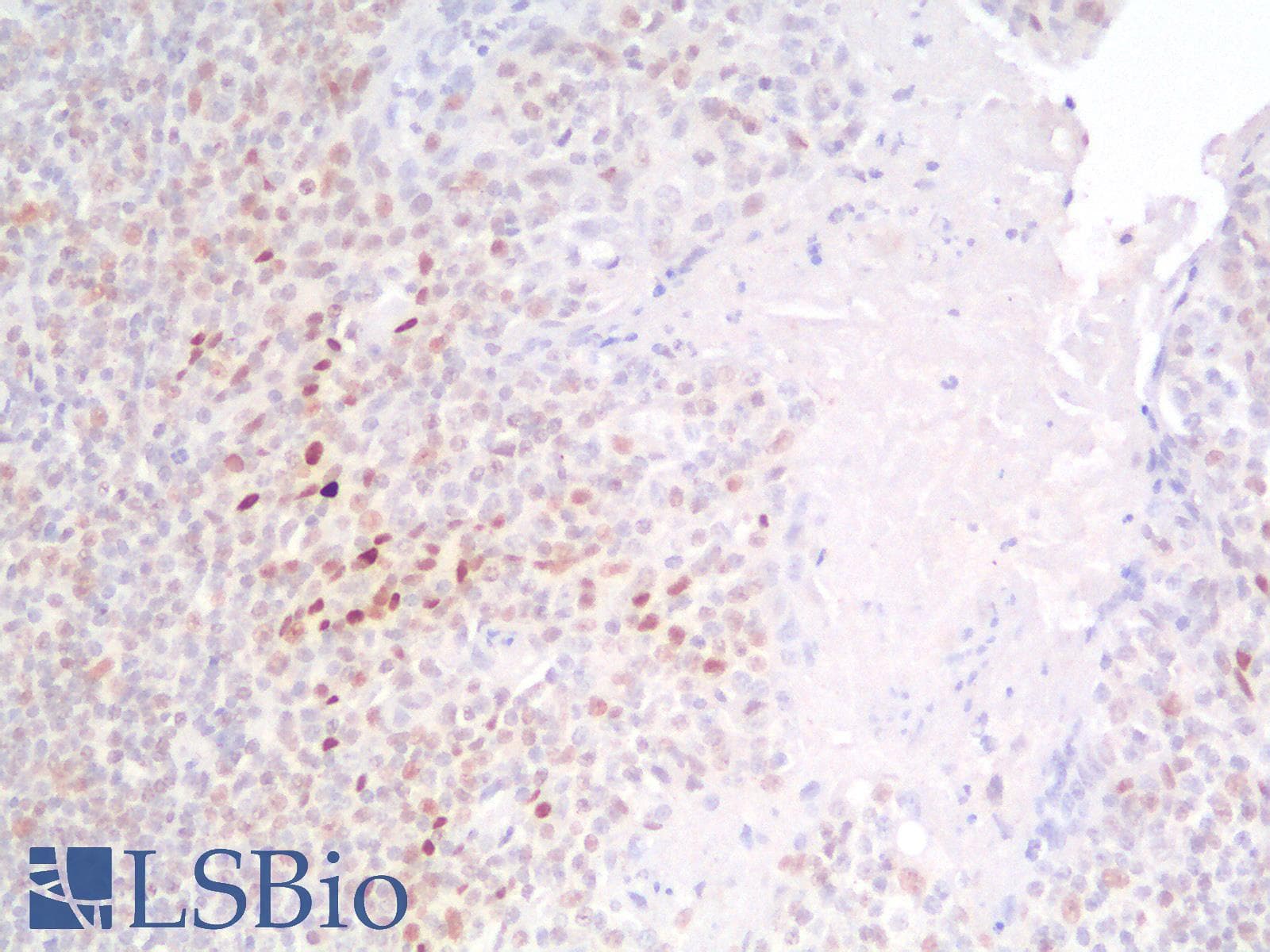PathPlus™ TP53 / p53 Antibody (clone rTP53/1739)