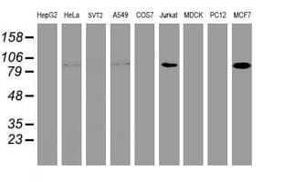 PFKP Antibody (clone OTI1A11)