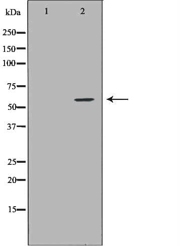 NCF2 / NOXA2 / p67phox Antibody