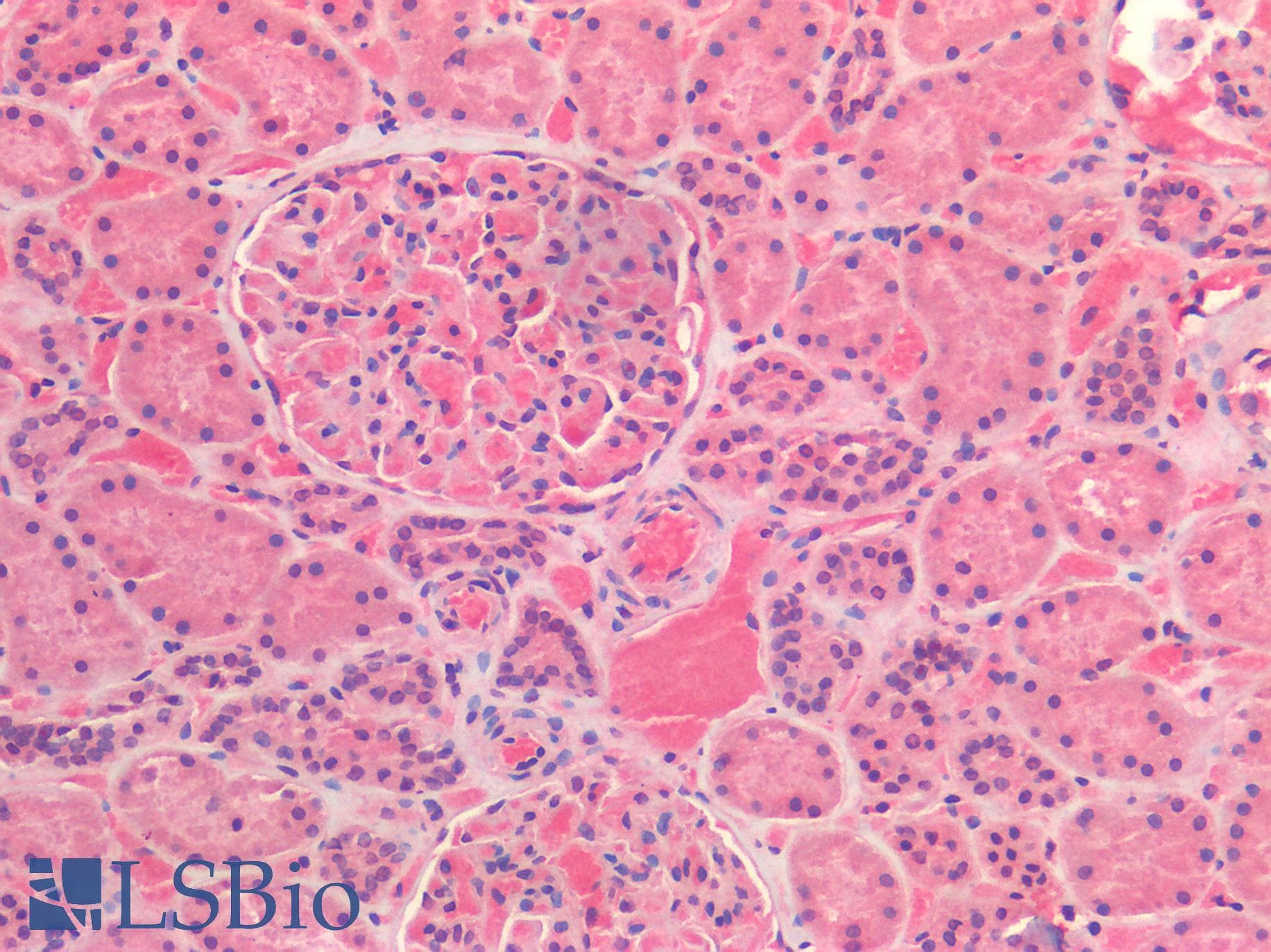 IHC-plus™ Polyclonal Rabbit anti-Human IL6 / Interleukin 6 Antibody (IHC)