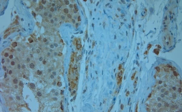 KCNJ13 / KIR7.1 Antibody (aa2-50)