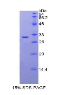 Rat LPO / Lactoperoxidase Protein (Recombinant His)