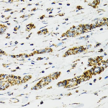 Polyclonal Rabbit anti-Human HSPA9 / Mortalin / GRP75 Antibody (IHC, IF, WB)