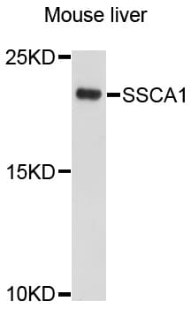 SSSCA1 / p27 Antibody