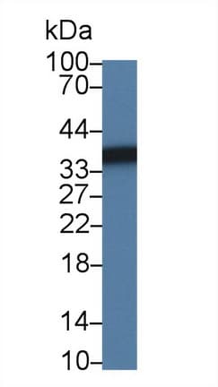 SORD / Sorbitol Dehydrogenase Antibody (aa4-344)