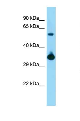 Polyclonal Rabbit anti-Mouse BMI1 / PCGF4 Antibody (aa181-230, WB)