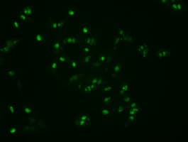 NOG / Noggin Antibody (clone OTI4C12)