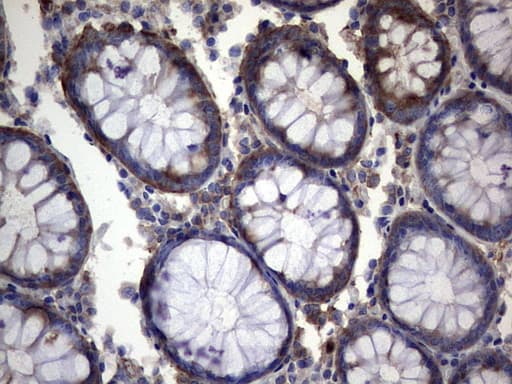PKM2 Antibody (clone 14C7)