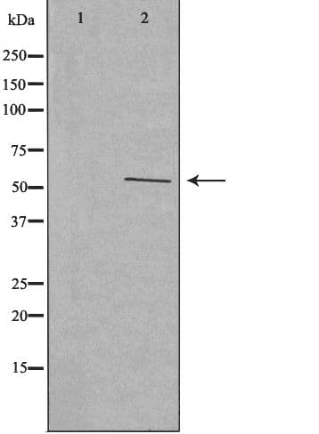 CYP2W1 Antibody