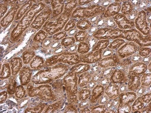Polyclonal Rabbit anti-Human NOS2 / iNOS Antibody (aa115-304, IHC)