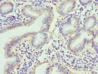 RBP2 / CRBPII Antibody
