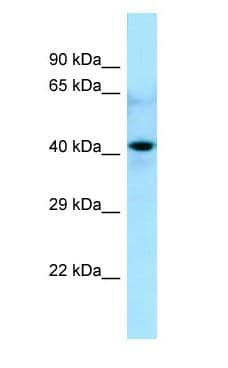 Polyclonal Rabbit anti-Human CDC20B Antibody (N-Terminus, WB)