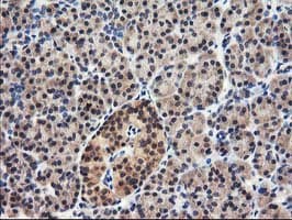 NUDT18 Antibody (clone OTI5F9)