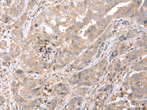 CXCL7 / PPBP Antibody